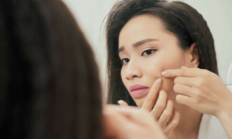 6 Cara Menghilangkan Jerawat Dengan Cepat