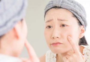 8 Cara Menghilangkan Komedo Dengan Cepat Dan Permanen