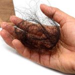 8 Cara Merawat Rambut Rontok Terbukti Sangat Ampuh!