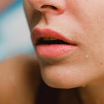 Penyebab Bibir Hitam dan Cara Mengatasinya