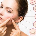 8 Tanda Kulit Kamu Nggak Cocok dengan Skincare Kamu Saat Ini